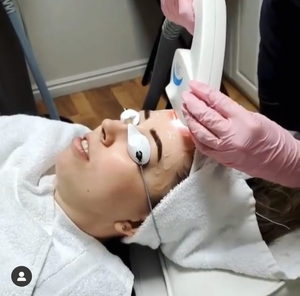 Young woman receiving laser treatment | Mandalyn Academy in American Fork, UT